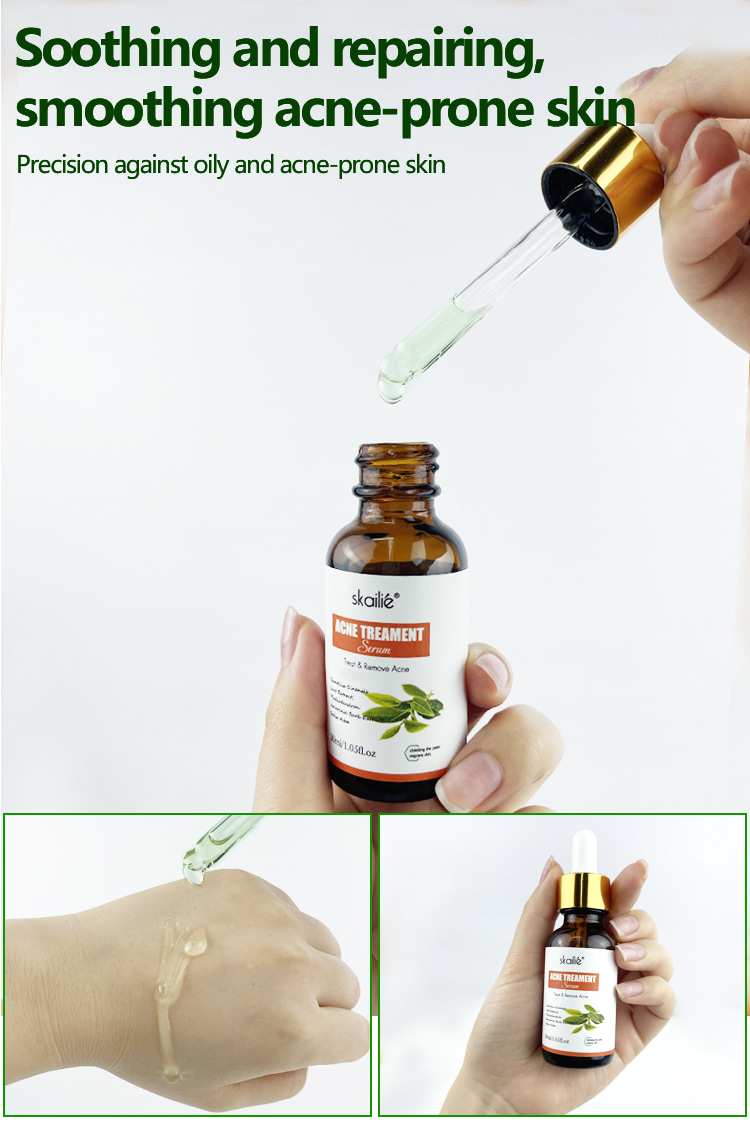 Sérum de traitement de l'acné