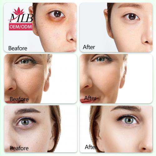 Masque pour les yeux au collagène à l'aloe vera de Skailie