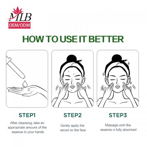 Sérum de traitement de l'acné à l'arbre à thé Skailie